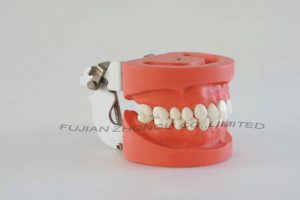 Dental Hard Gingiva Jaw