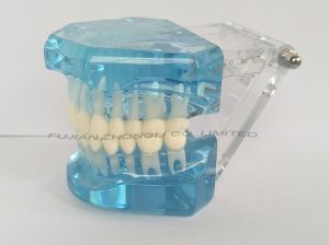 Cheap Dental Transparent Dental Model