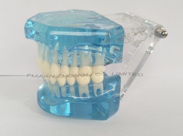 Cheap Dental Transparent Dental Model