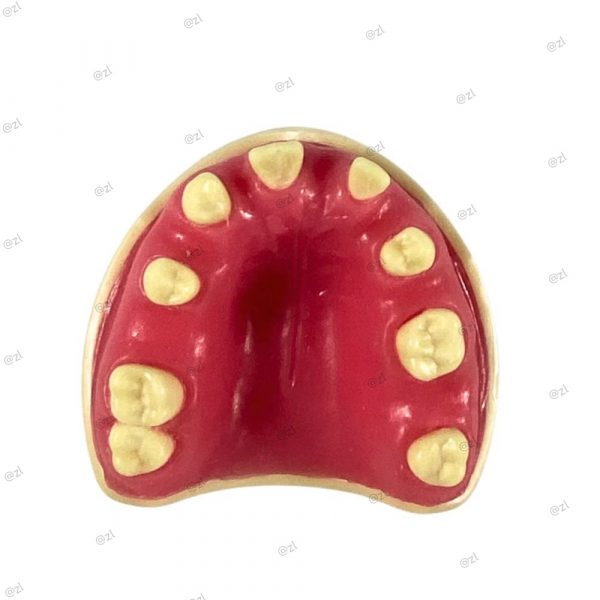 Upper jaw dental implant training model with partial dentition