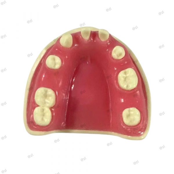 Dental model of upper jaw with partial missing teeth for implant simulation