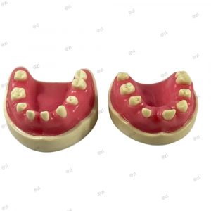 Full set of upper and lower jaw dental implant training models