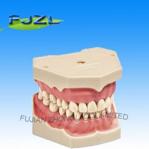 Dental Typodonts with Removable Screw Teeth