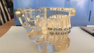 Orthodontic Clear Dental Oral Teeth with Ceramic Bracket
