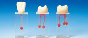 High Quality Resin Root Canal Filling S6