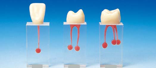 High Quality Resin Root Canal Filling S6