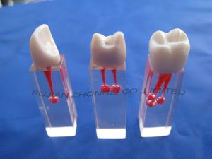 Cheap Root Canal Filling S6