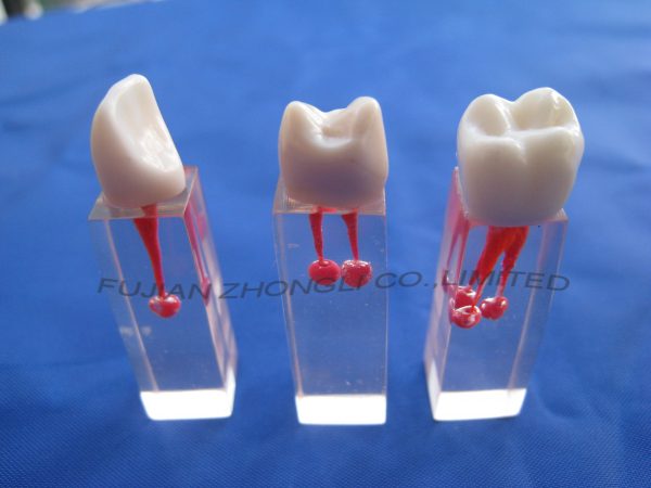 Cheap Root Canal Filling S6