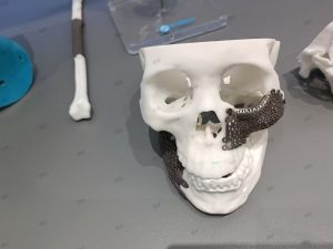 3D-Printed Skulls and Knee Joints in The Biomedical Field