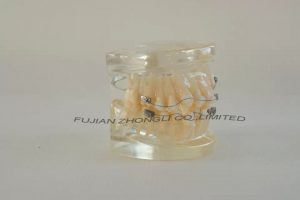 Top Quality Orthodontic Demonstrator Model