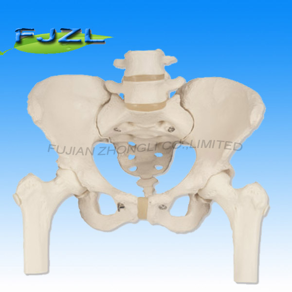 Pelvis with Lumbar Spine and Femoral Head