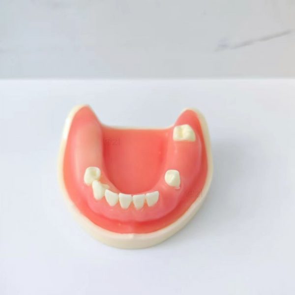 Lower jaw dental model with anterior and molar teeth for implant training