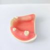 Mandibular dental training model with soft gum and posterior teeth