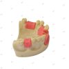 Side angle of dental implant practice model showing tooth gaps, removable teeth, and gum simulation