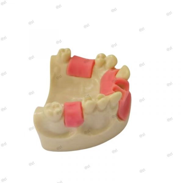 Side angle of dental implant practice model showing tooth gaps, removable teeth, and gum simulation