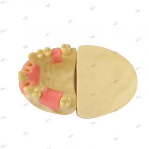 Upper jaw dental implant practice model showing removable base for teaching and demonstration