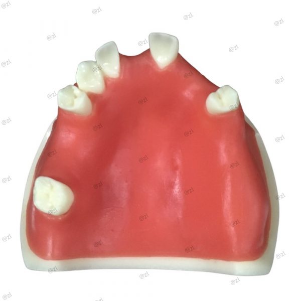 Upper jaw implant training model with partial dentition and soft gum (top view)