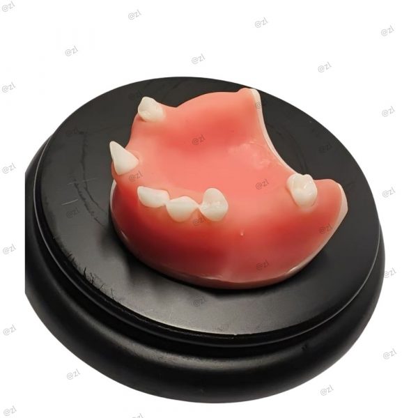 Half upper jaw implant model with soft gum on black base