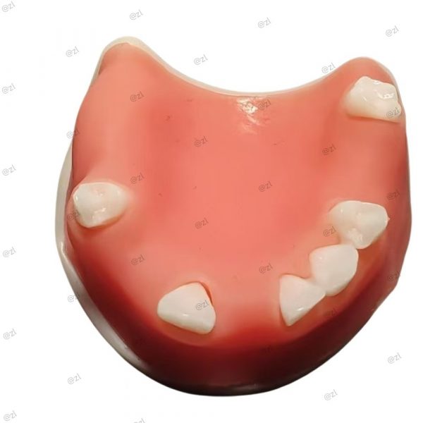 Close-up of upper jaw partial dentition for implant practice