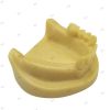 Lower jaw partial edentulous dental implant model