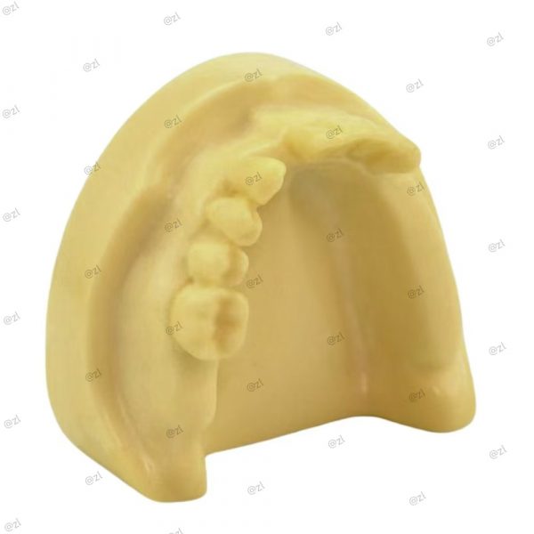 ZL DT25717 Partial Edentulous Lower Jaw Implant Model Resin Drill 