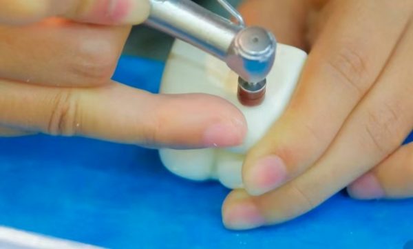 Dental Implant Sinus Lift Training Model For Surgery Practice