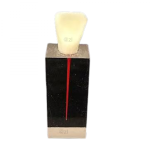 Transparent Three Root Canal Dental Model with Resin Tooth