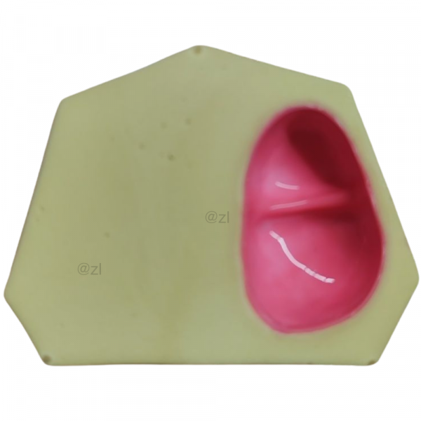 Dental model base showing maxillary sinus cavity structure for sinus lift practice