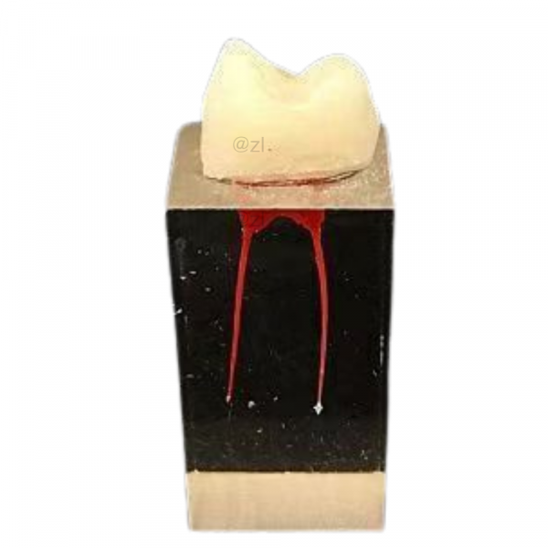Dual Root Canal Resin Tooth Model for Dental Training