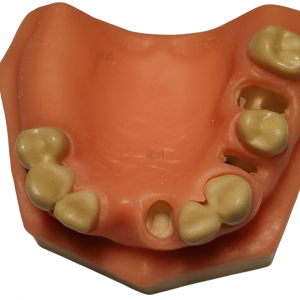 Upper jaw dental model with soft gingiva and clear implant preparation sites for training purposes