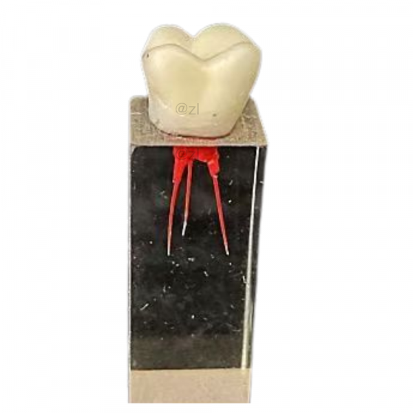 Transparent Resin Single Root Canal Tooth Model with Pulp Anatomy