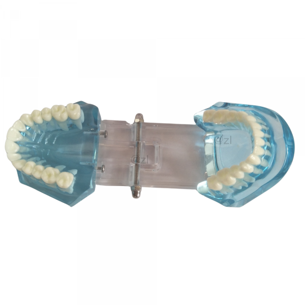 Top-down view of upper and lower jaw in transparent dental model