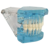 Full arch transparent dental model side view