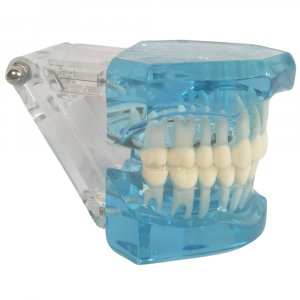 Full arch transparent dental model side view