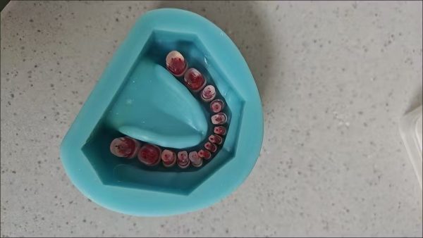 Dental Root Canal Training Model with Silicone Jaw for Endodontic Practice Dental root canal training model with silicone jaw base and transparent endodontic practice teeth for dental students training