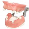 Realistic Gingiva Dental Model for Tooth Loss Training