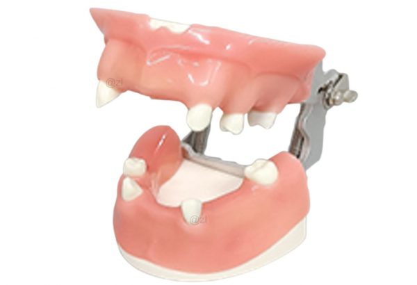 Realistic Gingiva Dental Model for Tooth Loss Training