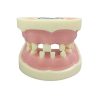 Dental Implant Practice Model – Realistic Missing Teeth Structure Dental implant training model with missing teeth and realistic gums for oral surgery practice