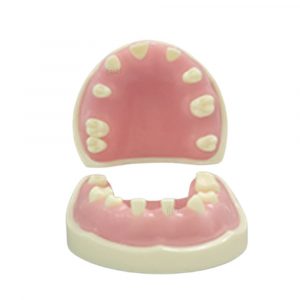 Upper and lower jaw dental implant model with missing teeth for training
