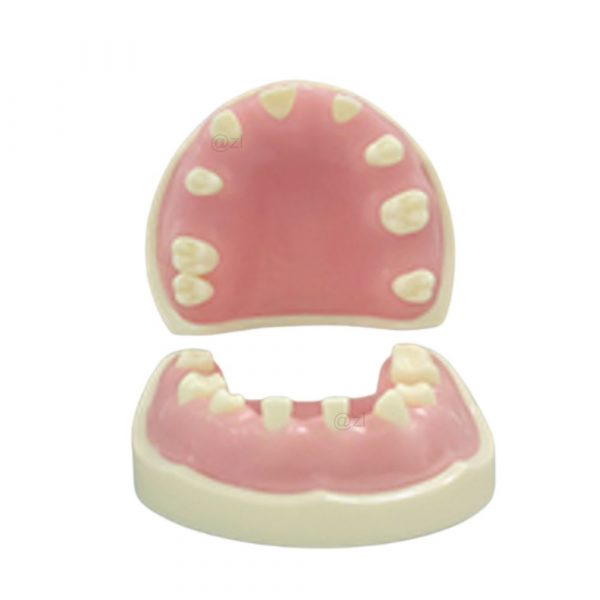 Upper & Lower Jaw Implant Training Model – Educational Tool Upper and lower jaw dental implant model with missing teeth for training