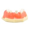 Partial Jaw Dental Training Model Partial upper jaw model with gum and several teeth for dental training