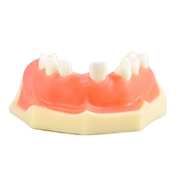 Partial Jaw Dental Training Model Partial upper jaw model with gum and several teeth for dental training