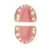 Removable Jaw Implant Practice Model – Dental Education Supply Dental implant simulation model showing removable upper and lower jaws for practice
