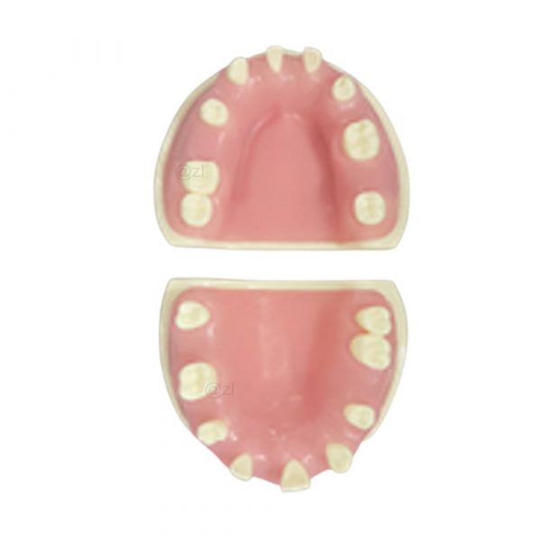 Removable Jaw Implant Practice Model – Dental Education Supply Dental implant simulation model showing removable upper and lower jaws for practice