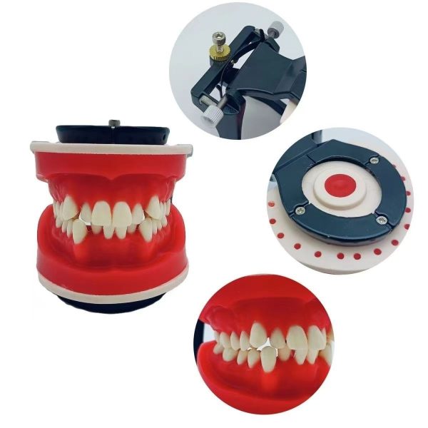 Dental orthodontic model showing teeth alignment and occlusion relationship