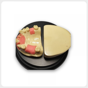 -1 Dental Implant Practice Model