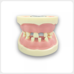 Dental Implant Practice Model – Realistic Missing Teeth Structure Dental implant training model with missing teeth and realistic gums for oral surgery practice