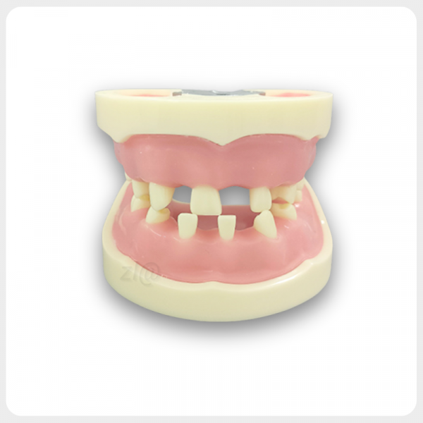 Dental implant training model with missing teeth and realistic gums for oral surgery practice