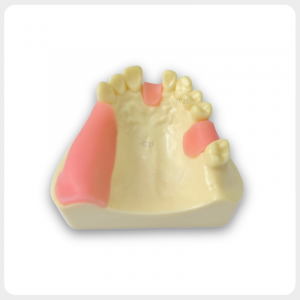 Upper Arch Dental Model with Simulated Gingiva and Missing Teeth Dental Model with Partial Upper Arch Teeth and Gingiva for Prosthodontic Training