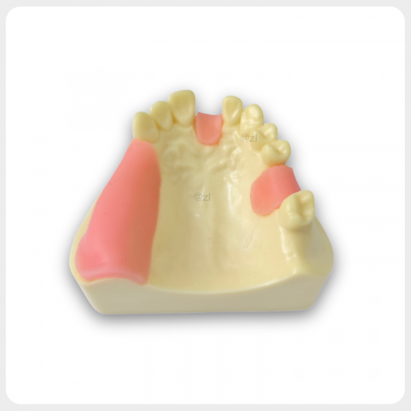 Upper Arch Dental Model with Simulated Gingiva and Missing Teeth Dental Model with Partial Upper Arch Teeth and Gingiva for Prosthodontic Training